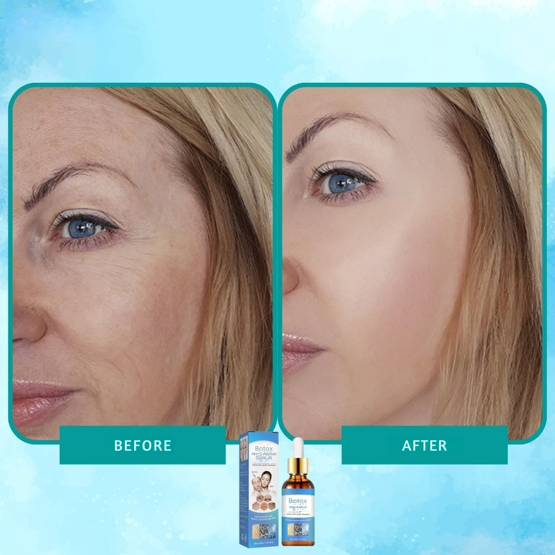 Intense anti-rimpel botox serum elixir 