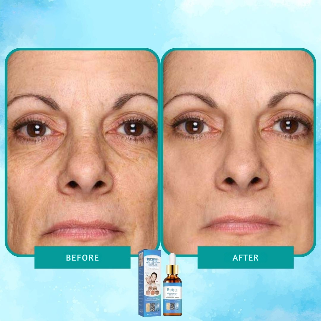 Intense anti-rimpel botox serum elixir 